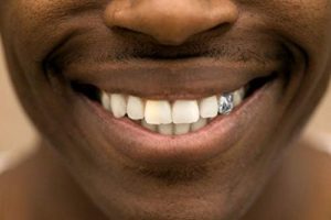 تفسير حلم الأسنان الفضة